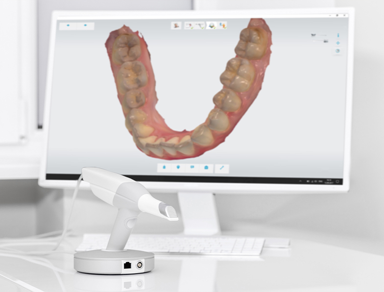 Digital model of a row of teeth on computer screen